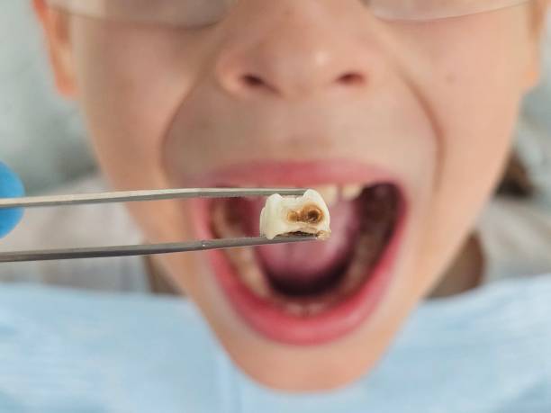 Best Emergency Care for Gum Disease in Dry Run, OH